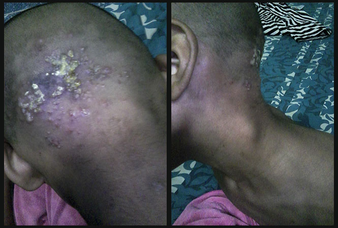 CHRISTIAN CHILD IN DESPERATE NEED OF MEDICAL ATTENTION.